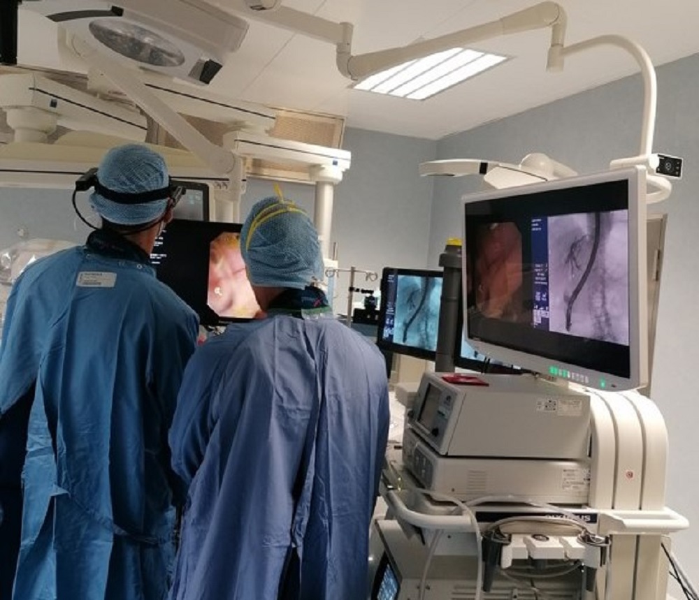 Endoscopia smart glasses 1000